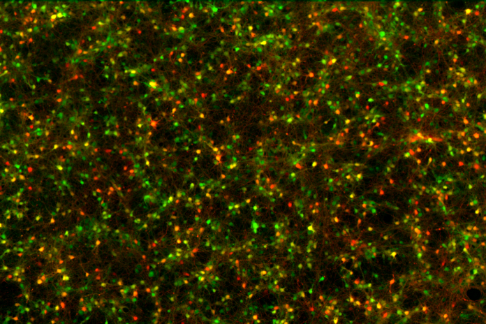 Cultivo de neuronas con marcaje fluorescente: la investigación que sigue la sección de noticias